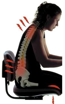 Poor posture before chiropractic care
