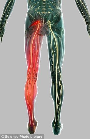 Improved posture after chiropractic care